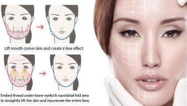 قیمت کوکتل لیفت صورت : ده روش برای درمان افتادگی پوست صورت