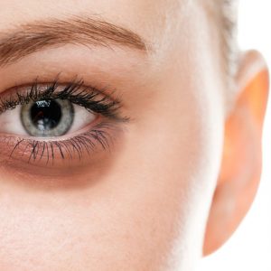 کوکتل درماهیل : درمان پف زیر چشم با ۱۲ توصیه ساده اما موثر