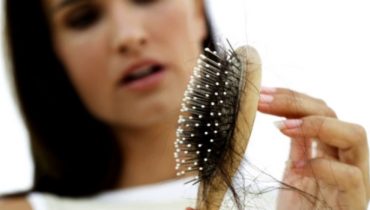 علت ریزش مو در دوران نوجوانی و نکاتی برای بهبود آن